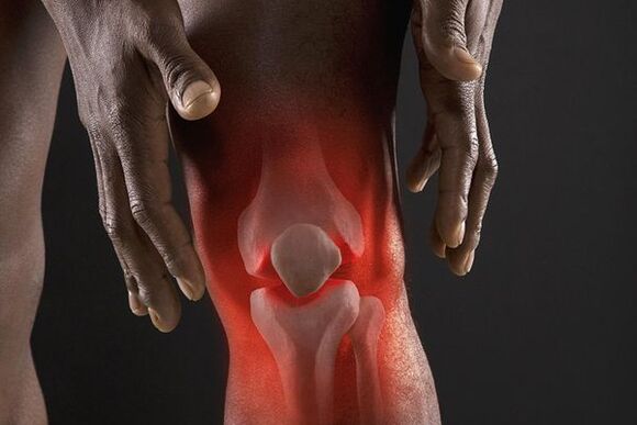 Symptome der Arthrose