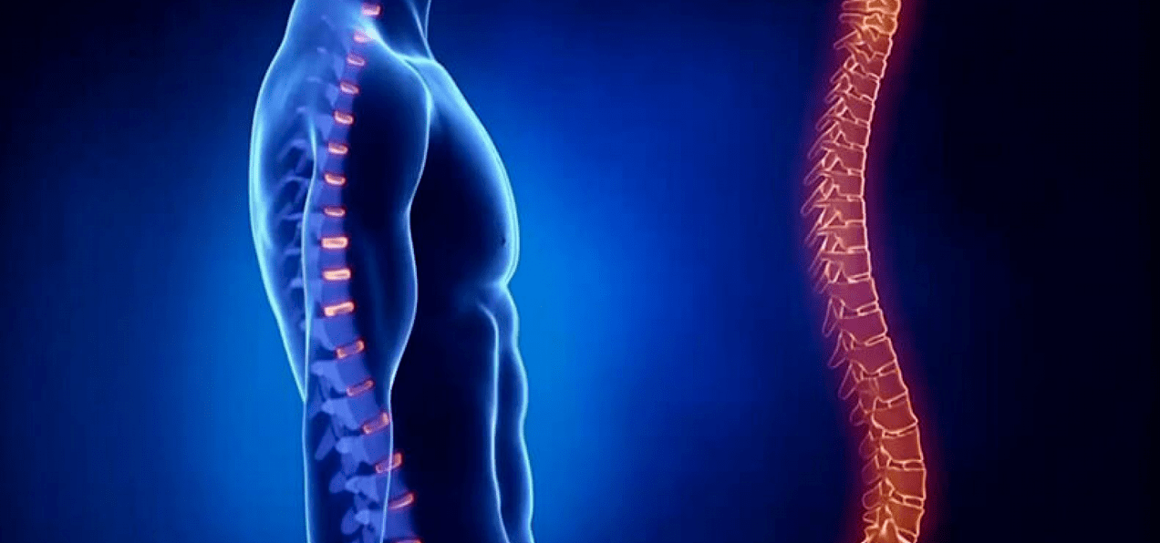 Wirbelsäulenläsionen aufgrund von Osteochondrose