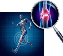 Arthrose des Kniegelenks